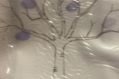 Kelly_s-tree